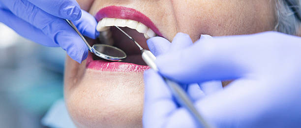 Best Emergency Tooth Extraction in Auburn, KS
